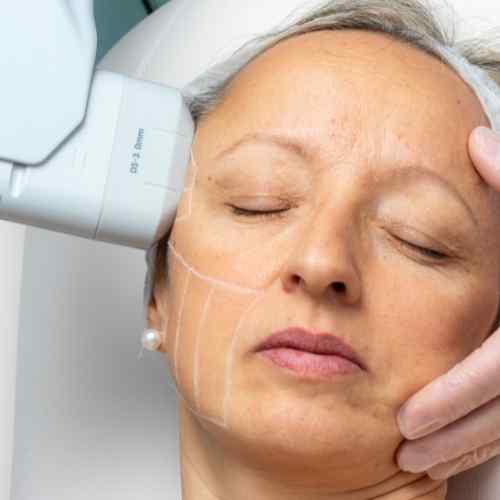 About us Aldershot - Safe Treatments. No Downtime. Real Results.