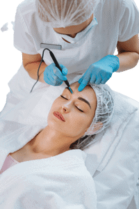 Cryopen Blemish Removal Aldershot