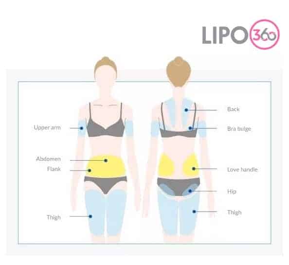 Various Areas of the Body We Treat with Cryolipolysis Aldershot