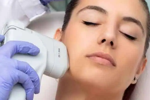 Image of woman having HIFU Aldershot treatment
