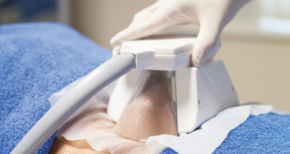 Multiple Areas in One Session HIFU and Fat Freezing Aldershot