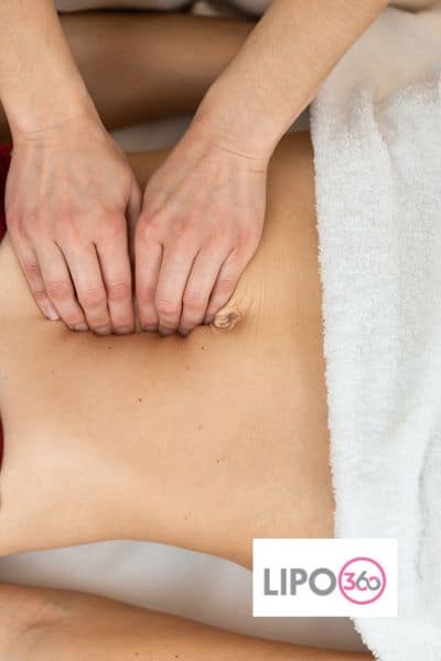 diastasis recti treatment Aldershot