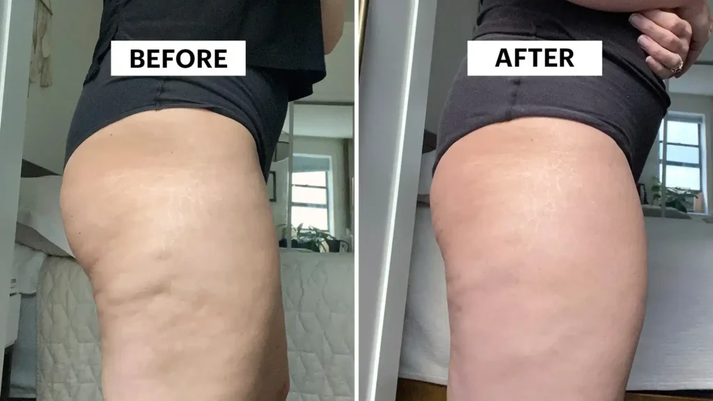 Do Toning Exercise Aldershot Really Tackle Cellulite?