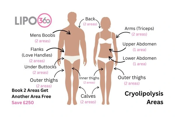 Cryolipolysis fat freezing prices from Lipo 360 Aldershot