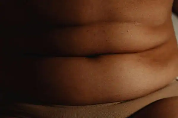 image of what stress can do on the stomach area and how Lipo 360 Aldershot can help to change your body shape.