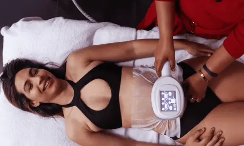 Woman having Body Sculpting treatment post injury Aldershot