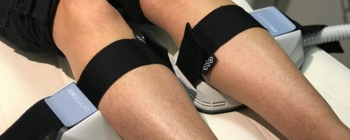 LIPO360 Body Sculpt Areas We Treat Aldershot Calves (Lower Legs)